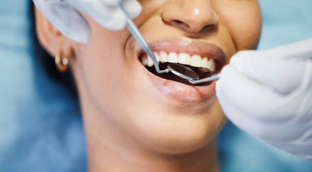 Best Emergency Broken Tooth Repair in Odessa, TX